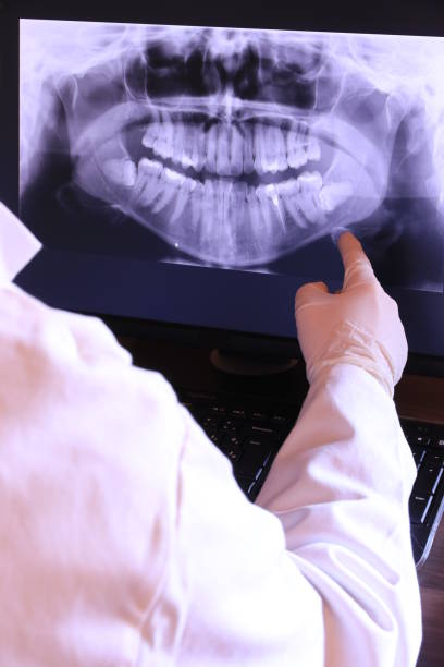 Best Emergency Treatment for Dental Infections or Abscesses in North Hudson, WI